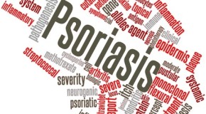 Plaque Psoriasis